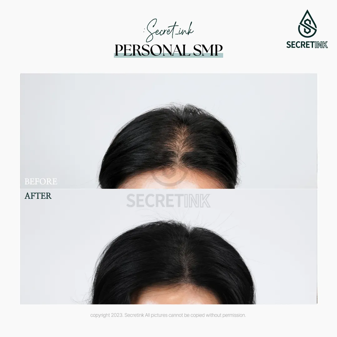 SECRET INK SCALP